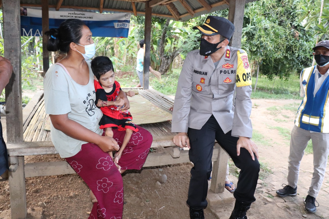 Kapolres Buleleng Beri  Bantuan Sosial Kepada Seorang Anak Yang Lumpuh.